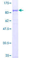 Recombinant Human CBS protein