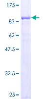 SDS-PAGE - Recombinant Human CBS protein (AB132564)