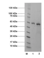 SDS-PAGE - Recombinant Human CBS protein (Active) (AB285970)