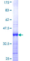 Recombinant Human CBX2 protein