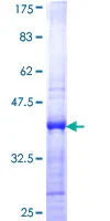 SDS-PAGE - Recombinant Human CBX2 protein (AB153555)