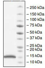 SDS-PAGE - Recombinant Human CBX2 protein (His tag N-Terminus) (AB198759)