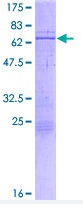 Recombinant Human CBX4 protein