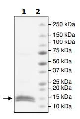 SDS-PAGE - Recombinant Human cbx7 protein (His tag N-Terminus) (AB198427)