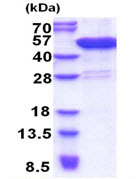 SDS-PAGE - Recombinant Human CCDC104 protein (His tag N-Terminus) (AB171497)