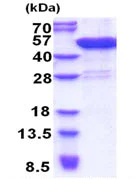 SDS-PAGE - Recombinant Human CCDC104 protein (His tag N-Terminus) (AB171497)