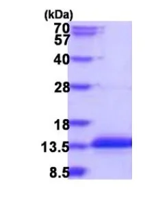 SDS-PAGE - Recombinant Human CCDC23 protein (AB187617)