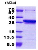 SDS-PAGE - Recombinant Human CCDC25 protein (AB168088), expandable thumbnail