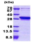 SDS-PAGE - Recombinant Human CCDC25 protein (His tag N-Terminus) (AB168088)