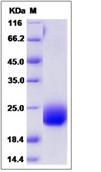 SDS-PAGE - Recombinant Human CCDC47 protein (His tag) (AB276524), expandable thumbnail