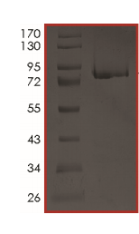 Recombinant human CCDC6 + RET protein