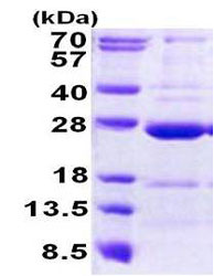 SDS-PAGE - Recombinant Human CCDC90B protein (His tag N-Terminus) (AB156720)