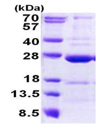 SDS-PAGE - Recombinant Human CCDC90B protein (His tag N-Terminus) (AB156720)