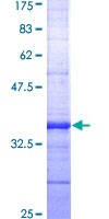 SDS-PAGE - Recombinant Human CCK2-R protein (GST tag N-Terminus) (AB152260)