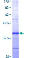 SDS-PAGE - Recombinant Human CCK2-R protein (GST tag N-Terminus) (AB152260)