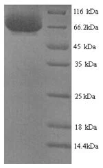 SDS-PAGE - Recombinant Human CCK4 protein (His tag) (AB241239)