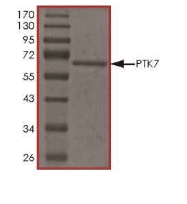 SDS-PAGE - Recombinant Human CCK4 protein (Tagged) (AB268895), expandable thumbnail