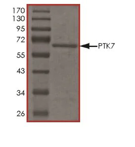 SDS-PAGE - Recombinant Human CCK4 protein (Tagged) (AB268895)