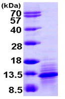 SDS-PAGE - Recombinant Human CCL1 protein (His tag N-Terminus) (AB104828)