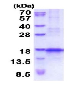 SDS-PAGE - Recombinant Human CCL25 protein (denatured) (AB202246), expandable thumbnail