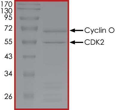 SDS-PAGE - Recombinant human CCNO protein (Active) (AB177582), expandable thumbnail