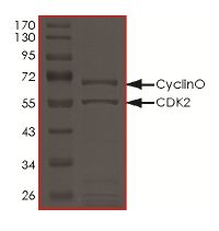 SDS-PAGE - Recombinant human CCNO protein (Active) (AB177582), expandable thumbnail