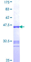 Recombinant Human CCP1 protein