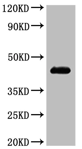 Western blot - Recombinant human CCR4 protein - Active (His tag) (AB314529)
