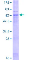 SDS-PAGE - Recombinant Human CCR5 protein (GST tag N-Terminus) (AB158144)