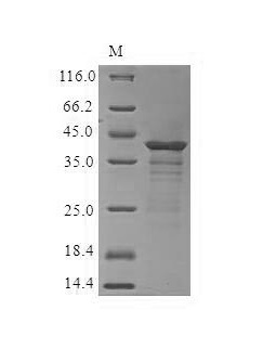 SDS-PAGE - Recombinant Human CCR6 Protein (His Tag) (AB314615)