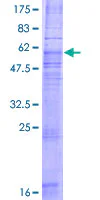 SDS-PAGE - Recombinant Human CCR8 protein (AB158145)