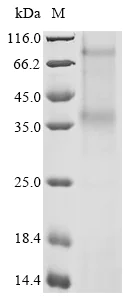 SDS-PAGE - Recombinant Human CCR8 protein (AB289764)