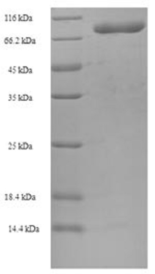 SDS-PAGE - Recombinant Human CCT2 protein (Tagged) (AB235076), expandable thumbnail