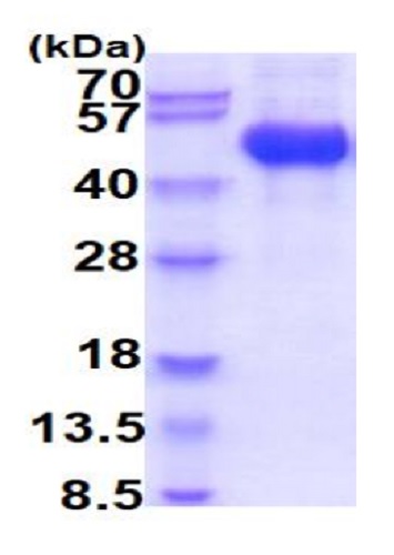 SDS-PAGE - Recombinant human CD116 protein (Active) (His tag C-Terminus) (AB227418)