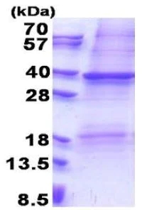 SDS-PAGE - Recombinant Human CD116 protein (denatured) (His tag N-Terminus) (AB171473)