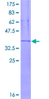 SDS-PAGE - Recombinant Human CD11c protein (GST tag N-Terminus) (AB158776)
