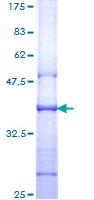 SDS-PAGE - Recombinant Human CD130 (gp130) protein (AB114303), expandable thumbnail