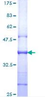 SDS-PAGE - Recombinant Human CD130 (gp130) protein (AB114303)