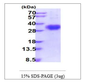 SDS-PAGE - Recombinant Human CD16 protein (His tag) (AB270574)