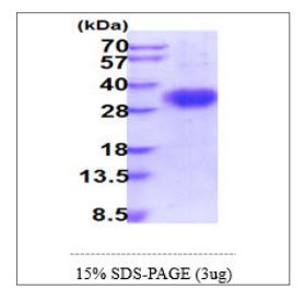 SDS-PAGE - Recombinant Human CD16 protein (His tag C-Terminus) (AB270574)
