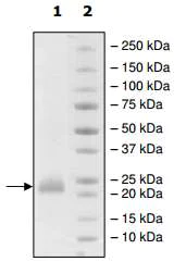 SDS-PAGE - Recombinant Human CD160 protein (His tag) (AB198433)