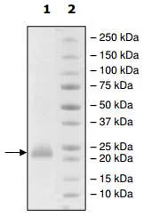 SDS-PAGE - Recombinant Human CD160 protein (His tag C-Terminus) (AB198433)