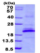 SDS-PAGE - Recombinant Human CD161 protein (denatured) (His tag N-Terminus) (AB131668)