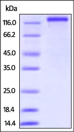 SDS-PAGE - Recombinant Human CD163 protein (His tag) (AB219873)