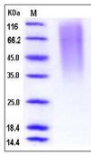 SDS-PAGE - Recombinant Human CD164 protein (His tag) (AB276474)