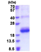 SDS-PAGE - Recombinant Human CD164L2 protein (His tag N-Terminus) (AB177674)
