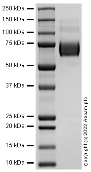SDS-PAGE - Recombinant Human CD166 protein (Active) (AB288795)