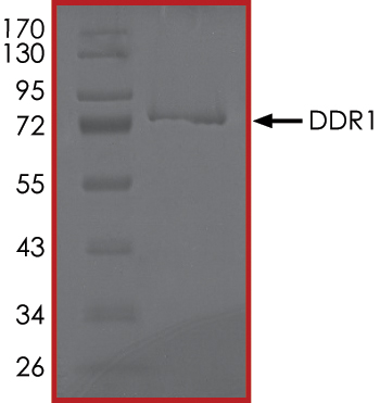 SDS-PAGE - Recombinant human CD167a/DDR1 protein (AB101591), expandable thumbnail