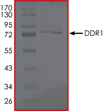 SDS-PAGE - Recombinant human CD167a/DDR1 protein (AB101591)