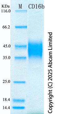 SDS-PAGE - Recombinant Human CD16b Protein Standard (His tag) (AB323823)